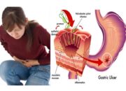 Ini Pertolongan Pertama Terhadap Penderita Penyakit Asam Lambung Saat Kumat